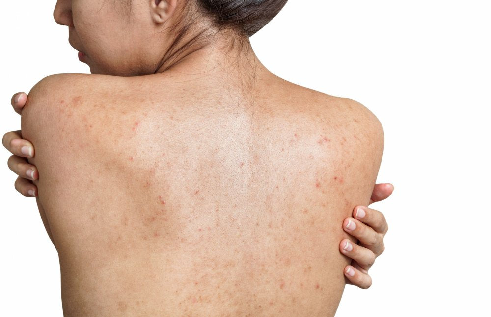 L'Exfoliation Naturelle : Sublimez Votre Peau avec le Gant en Soie