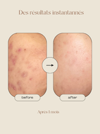 Masque Eclaircissant